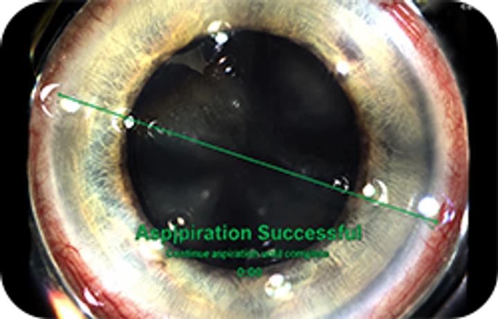 Greater patient comfort during surgery