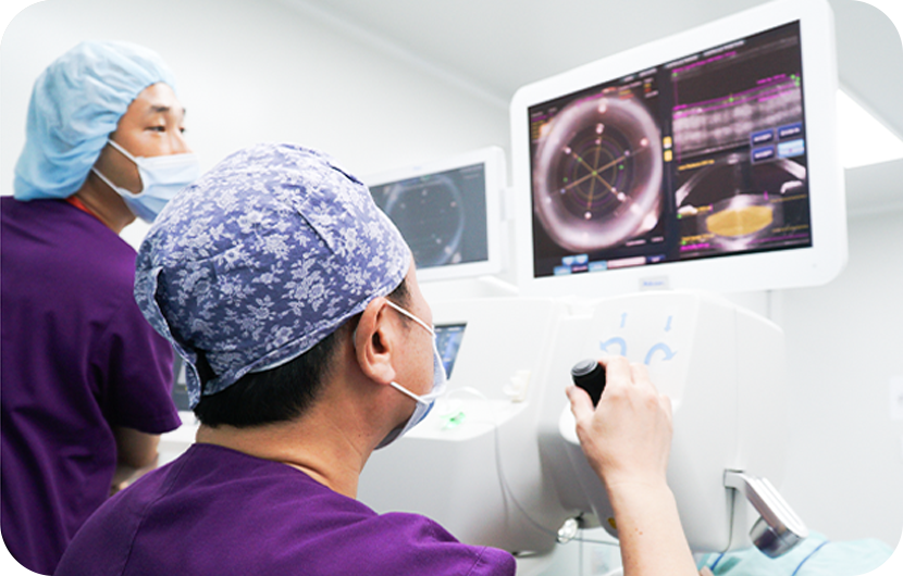Femtosecond laser cataract surgery diagram