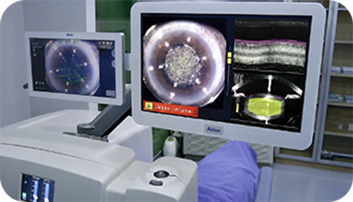 LenSx® femtosecond laser device