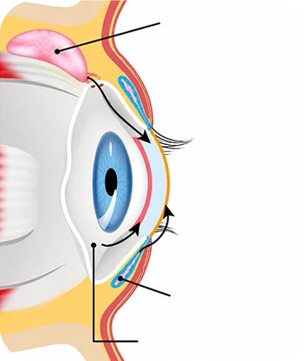 Anatomy illustration of dry-eye-related ocular structures