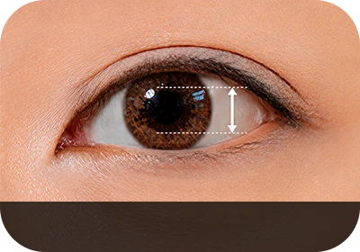 Normal Eyelid
