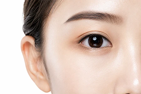 Conjunctival Nevus