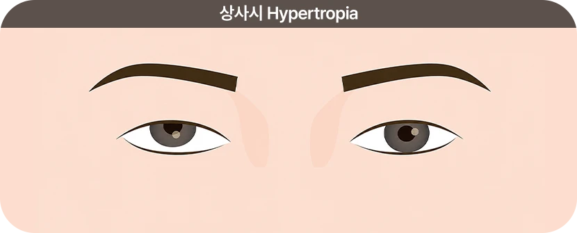상사시