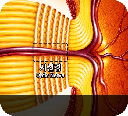 Normal optic nerve head