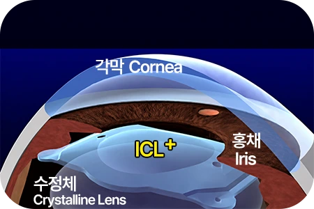 ICL Structure