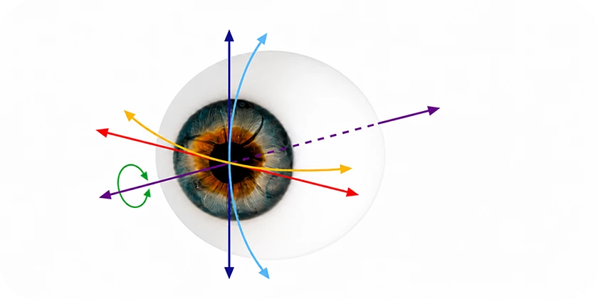 CustomFit LASEK 6D diagram