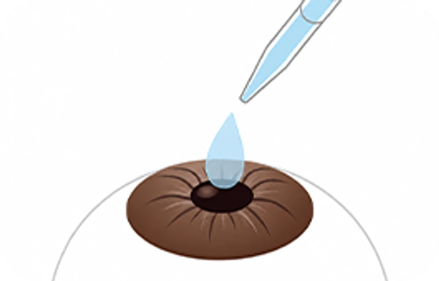 STEP 1 - Topical anesthesia