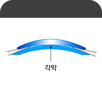 일반렌즈 구조