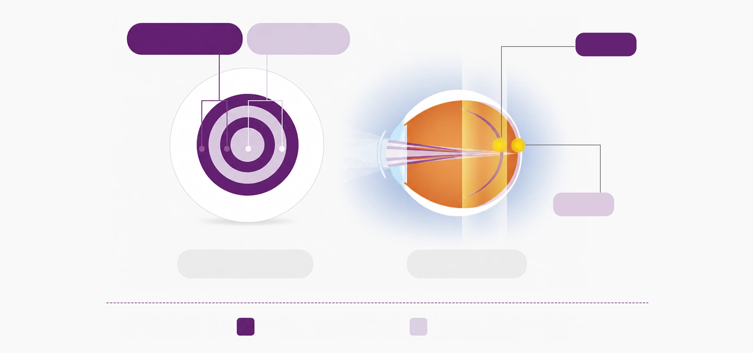 MiSight 1 day correction zone and treatment zone vision correction principle diagram