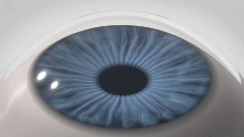 STEP 1 — lenticule formation